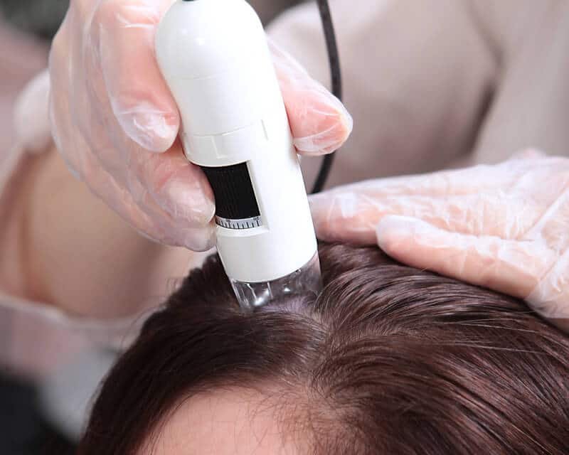 scalp-treatment-for-hair-loss